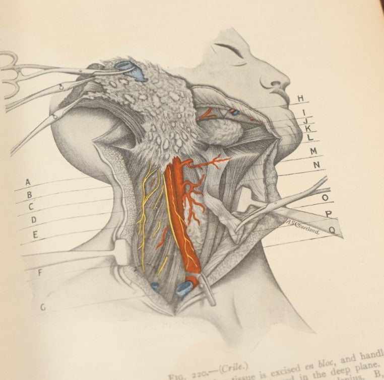 Lot 032 - "Manual Of Operative Surgery" Antique Medical Anatomy Book By John Fairbairn Binnie, With 1365 Illustrations, Including Many In Color, Fifth Edition, Published 1912