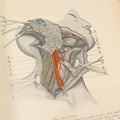 Lot 032 - "Manual Of Operative Surgery" Antique Medical Anatomy Book By John Fairbairn Binnie, With 1365 Illustrations, Including Many In Color, Fifth Edition, Published 1912