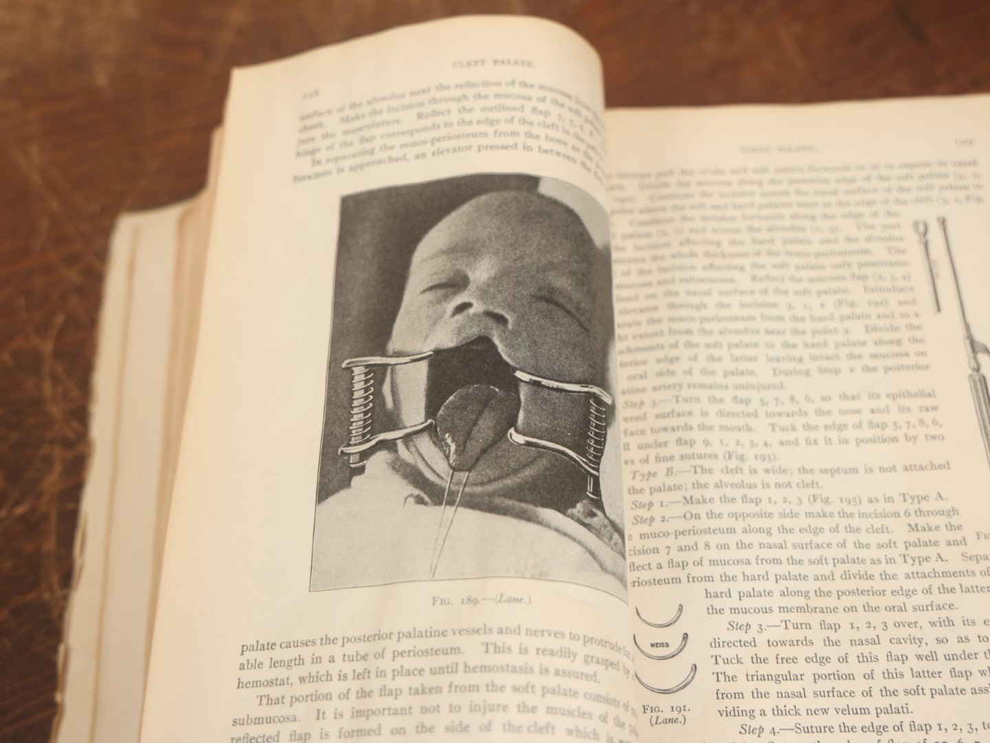 Lot 032 - "Manual Of Operative Surgery" Antique Medical Anatomy Book By John Fairbairn Binnie, With 1365 Illustrations, Including Many In Color, Fifth Edition, Published 1912