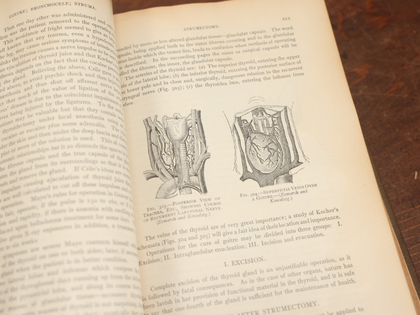 Lot 032 - "Manual Of Operative Surgery" Antique Medical Anatomy Book By John Fairbairn Binnie, With 1365 Illustrations, Including Many In Color, Fifth Edition, Published 1912