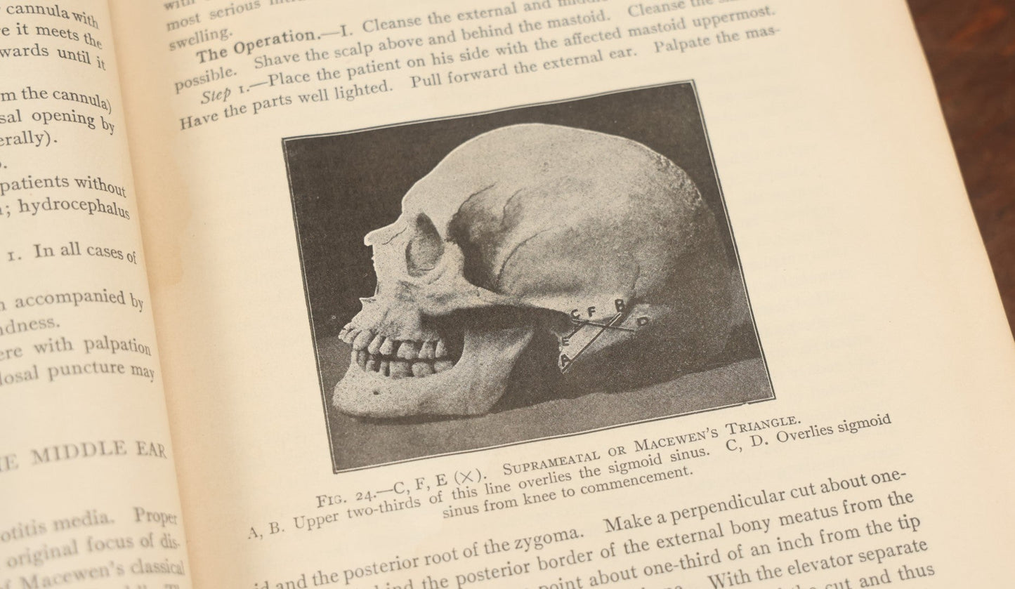 Lot 032 - "Manual Of Operative Surgery" Antique Medical Anatomy Book By John Fairbairn Binnie, With 1365 Illustrations, Including Many In Color, Fifth Edition, Published 1912