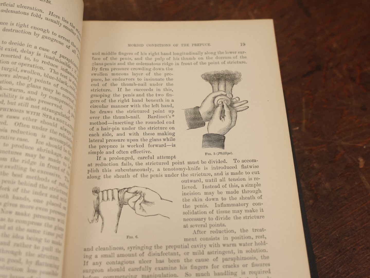 Lot 033 - "The Surgical Diseases Of The Genit-Urinary Organs Including Syphilis" Antique Medical Book By E.L. Keyes, M.D., Sparsely Illustrated, 1895