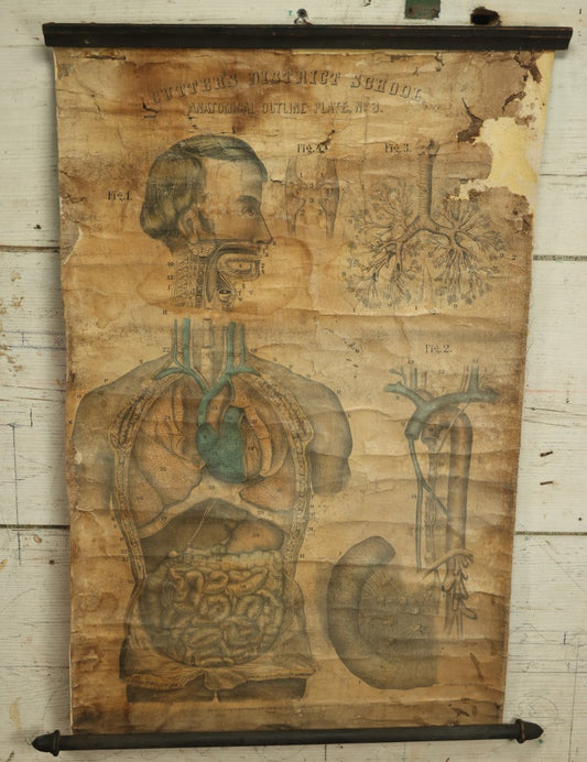 Lot 001 - 19th Century Canvas Anatomy Chart, Cutter's District School Anatomical Outline Plate No. 3, Copyright 1894 By Calvin Cutter, Massachusetts, Note Heavy Wear, Relined On Modern Canvas, 29" x 18-1/2"