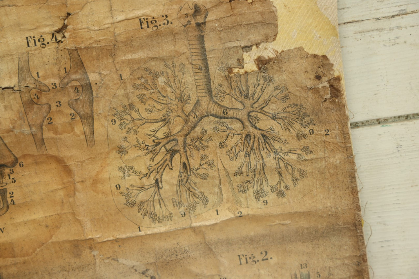 Lot 001 - 19th Century Canvas Anatomy Chart, Cutter's District School Anatomical Outline Plate No. 3, Copyright 1894 By Calvin Cutter, Massachusetts, Note Heavy Wear, Relined On Modern Canvas, 29" x 18-1/2"