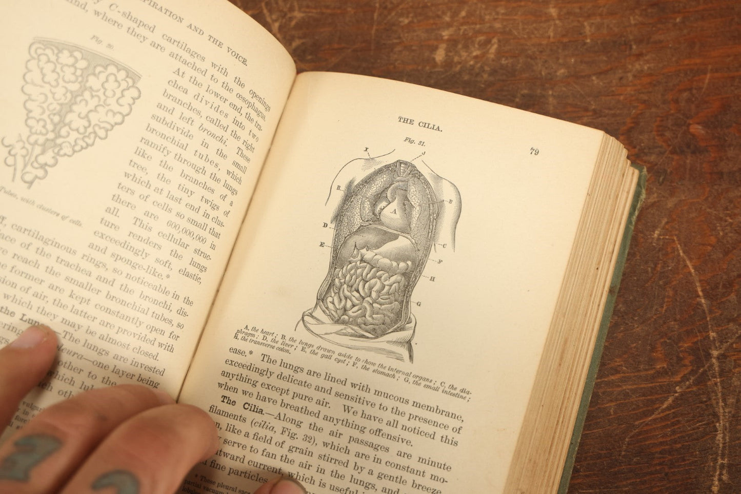 Lot 028 - "Hygienic Physiology" Antique Anatomy And Medicine Book With Many Illustrations, Full Color Plates, By Joel Dorman Steele, P.H.D., 1886