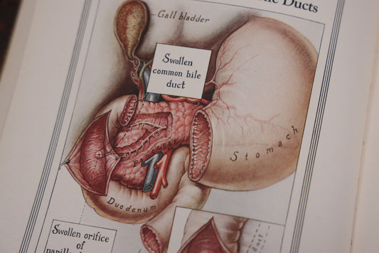 Lot 110 - Antique Illustrated "Gland Therapy" Book, With Full Color Medical Plates, By Reed And Carnrick, 1924, For The Physician