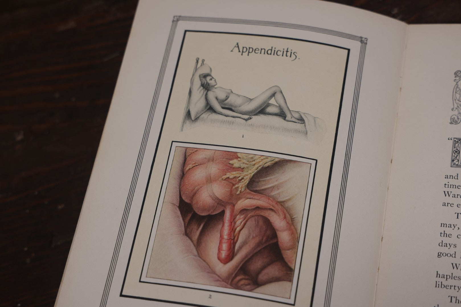 Lot 110 - Antique Illustrated "Gland Therapy" Book, With Full Color Medical Plates, By Reed And Carnrick, 1924, For The Physician