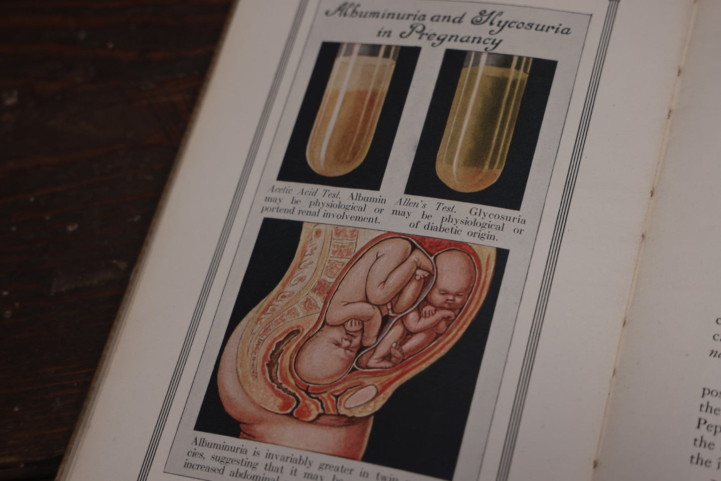 Lot 110 - Antique Illustrated "Gland Therapy" Book, With Full Color Medical Plates, By Reed And Carnrick, 1924, For The Physician