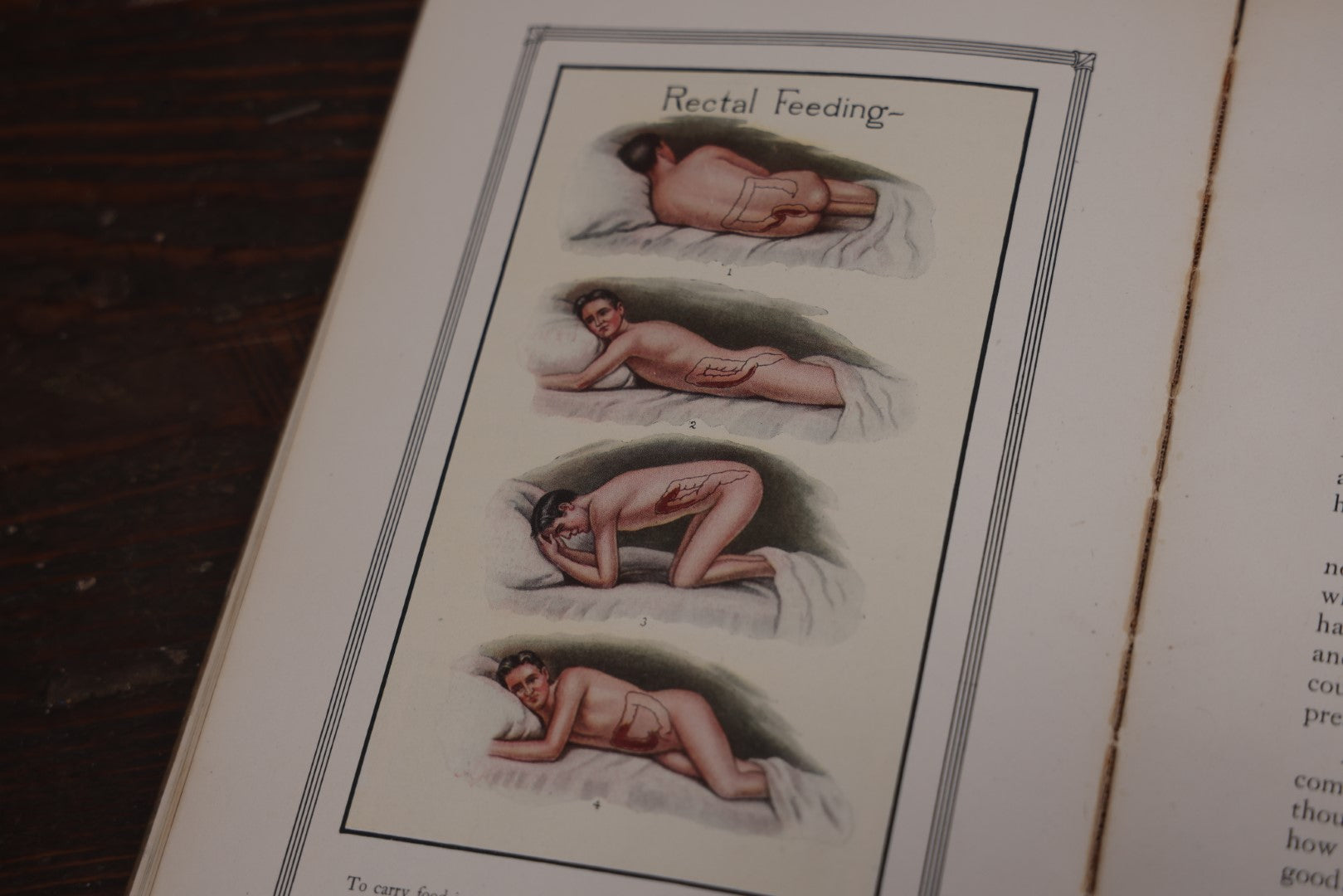 Lot 110 - Antique Illustrated "Gland Therapy" Book, With Full Color Medical Plates, By Reed And Carnrick, 1924, For The Physician