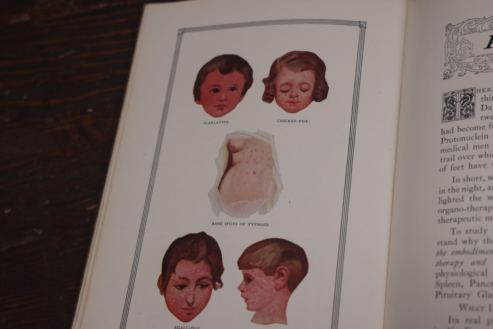 Lot 110 - Antique Illustrated "Gland Therapy" Book, With Full Color Medical Plates, By Reed And Carnrick, 1924, For The Physician