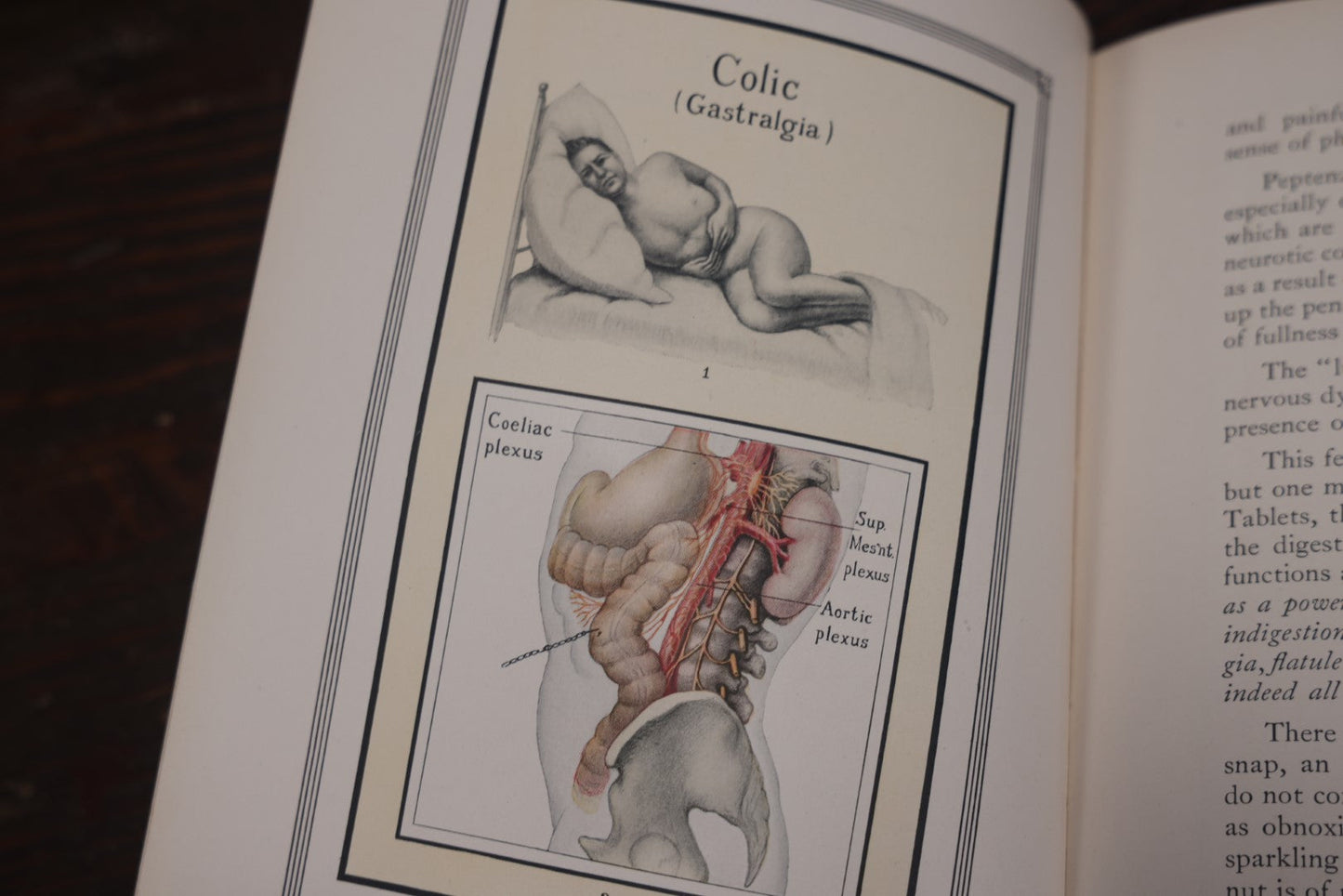 Lot 110 - Antique Illustrated "Gland Therapy" Book, With Full Color Medical Plates, By Reed And Carnrick, 1924, For The Physician