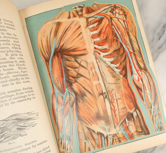 Lot 042 - "Domestic Medical Practice: A Household Adviser In The Treatment Of Diseases" Antique Medical Book Edited By Frank E. Miller, Et Al, Domestic Medical Society, 1917 Edition, With Many Fold Out Color Diagrams, Large And Heavy