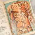 Lot 042 - "Domestic Medical Practice: A Household Adviser In The Treatment Of Diseases" Antique Medical Book Edited By Frank E. Miller, Et Al, Domestic Medical Society, 1917 Edition, With Many Fold Out Color Diagrams, Large And Heavy