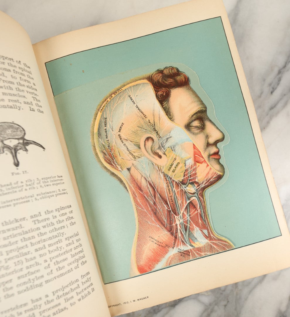 Lot 042 - "Domestic Medical Practice: A Household Adviser In The Treatment Of Diseases" Antique Medical Book Edited By Frank E. Miller, Et Al, Domestic Medical Society, 1917 Edition, With Many Fold Out Color Diagrams, Large And Heavy