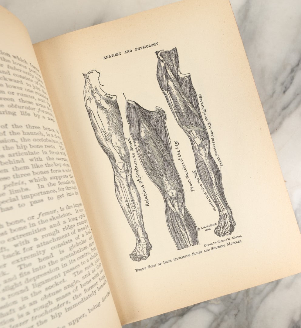 Lot 042 - "Domestic Medical Practice: A Household Adviser In The Treatment Of Diseases" Antique Medical Book Edited By Frank E. Miller, Et Al, Domestic Medical Society, 1917 Edition, With Many Fold Out Color Diagrams, Large And Heavy