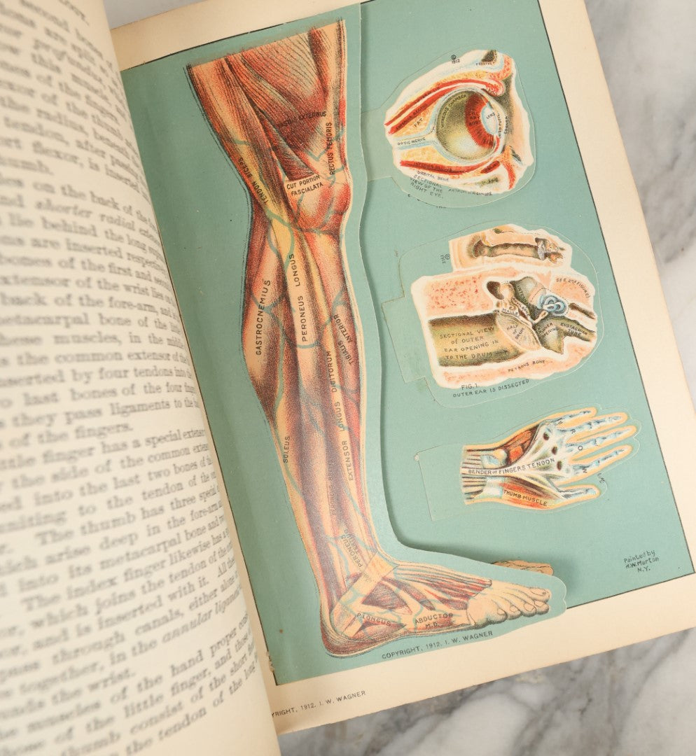Lot 042 - "Domestic Medical Practice: A Household Adviser In The Treatment Of Diseases" Antique Medical Book Edited By Frank E. Miller, Et Al, Domestic Medical Society, 1917 Edition, With Many Fold Out Color Diagrams, Large And Heavy