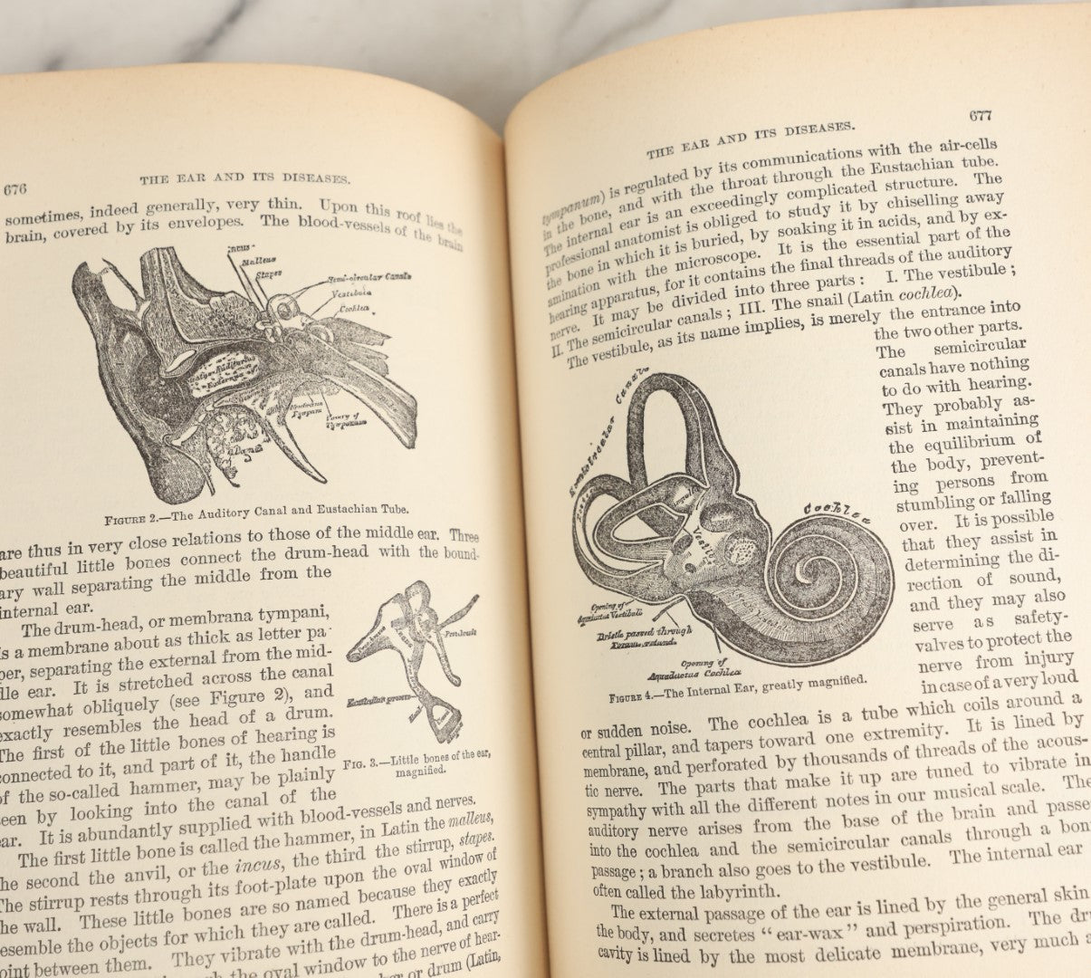 Lot 042 - "Domestic Medical Practice: A Household Adviser In The Treatment Of Diseases" Antique Medical Book Edited By Frank E. Miller, Et Al, Domestic Medical Society, 1917 Edition, With Many Fold Out Color Diagrams, Large And Heavy