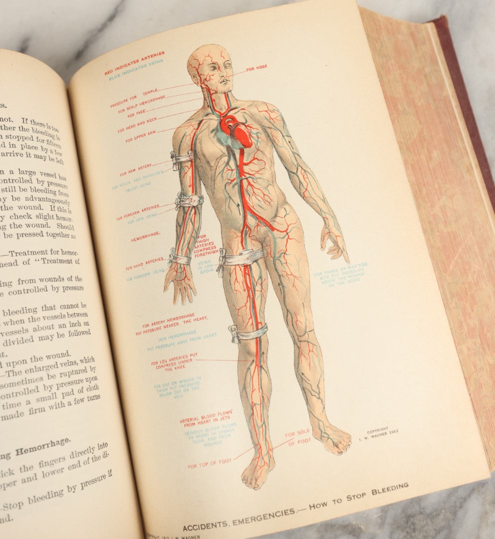 Lot 042 - "Domestic Medical Practice: A Household Adviser In The Treatment Of Diseases" Antique Medical Book Edited By Frank E. Miller, Et Al, Domestic Medical Society, 1917 Edition, With Many Fold Out Color Diagrams, Large And Heavy