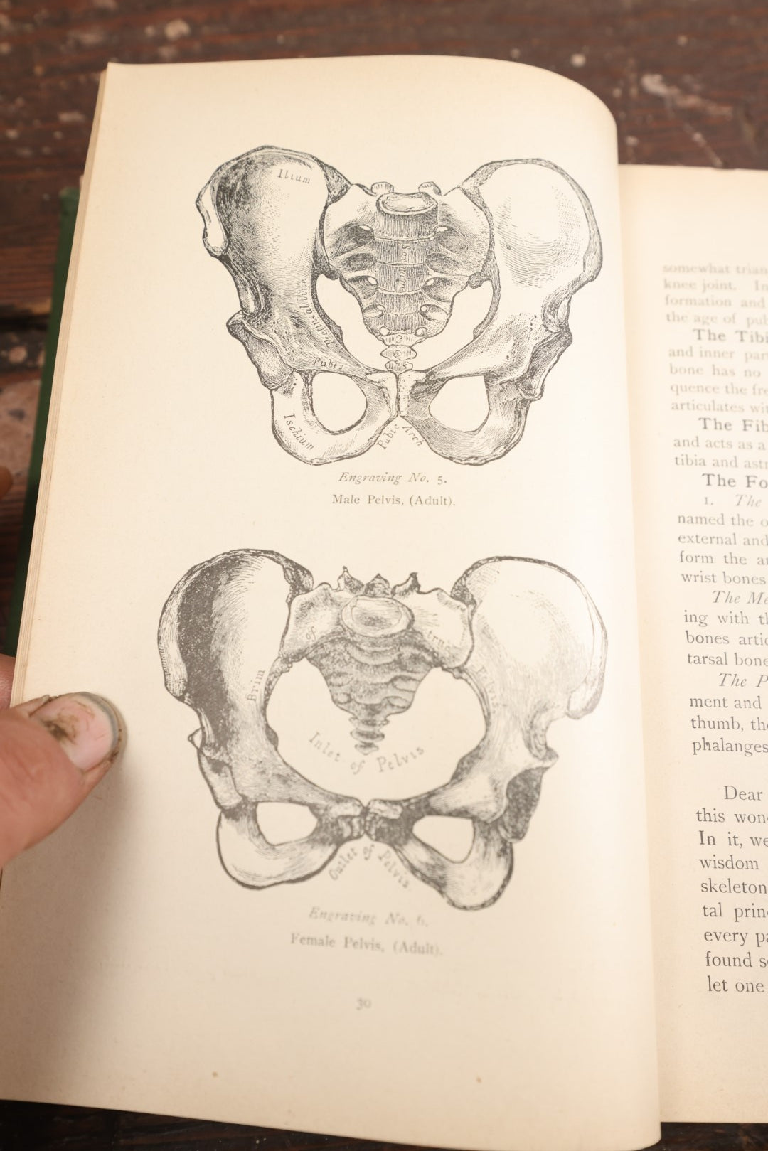 Lot 075 - "Prescriptions And How To Use Them: An Anatomical And Physiological Treatise On The Human Body With Practical Descriptions Of Its Diseases, Their Symptoms And Treatment" Antique Book, Volume I, 1892, Illustrated