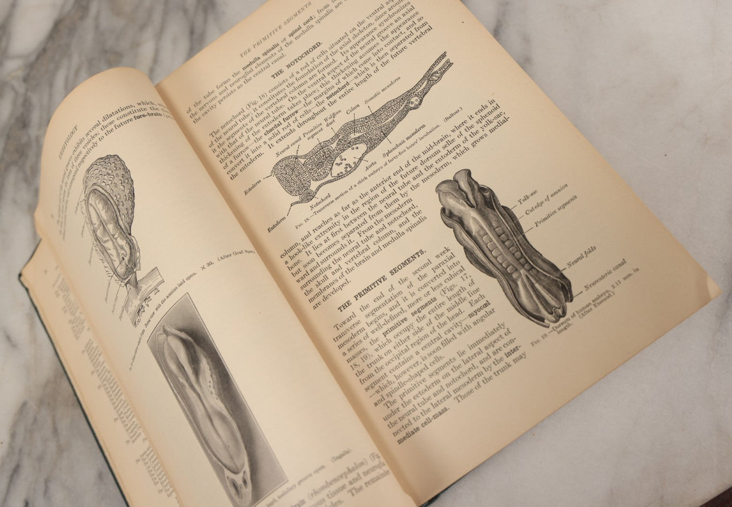 Lot 010 - "Anatomy Of The Human Body" Antique Book By Henry Gray (A.K.A. Gray's Anatomy), Twenty-First Edition, Illustrated With 1283 Engravings, Lea & Febiger Publishers, 1924