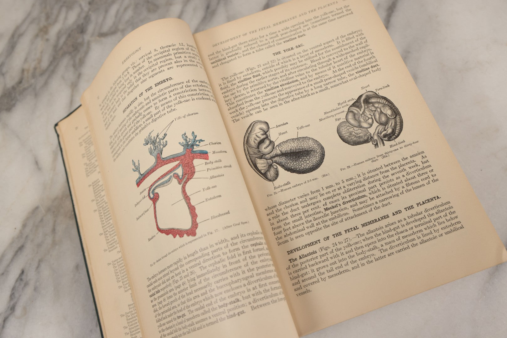 Lot 010 - "Anatomy Of The Human Body" Antique Book By Henry Gray (A.K.A. Gray's Anatomy), Twenty-First Edition, Illustrated With 1283 Engravings, Lea & Febiger Publishers, 1924