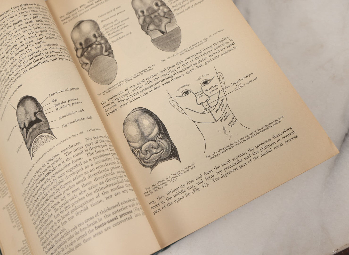 Lot 010 - "Anatomy Of The Human Body" Antique Book By Henry Gray (A.K.A. Gray's Anatomy), Twenty-First Edition, Illustrated With 1283 Engravings, Lea & Febiger Publishers, 1924