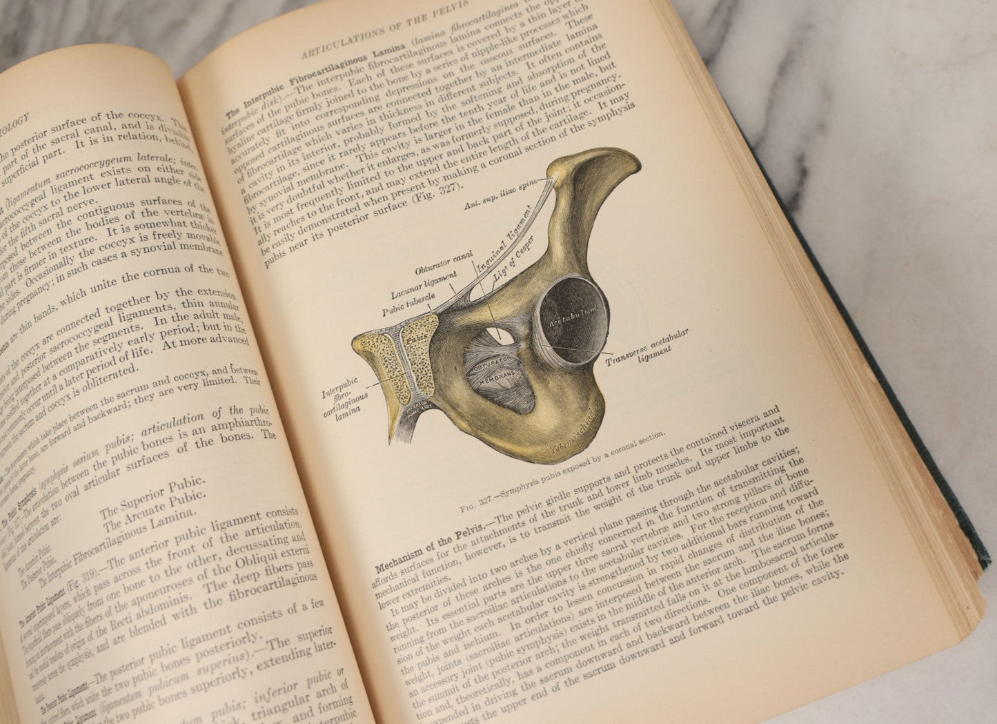 Lot 010 - "Anatomy Of The Human Body" Antique Book By Henry Gray (A.K.A. Gray's Anatomy), Twenty-First Edition, Illustrated With 1283 Engravings, Lea & Febiger Publishers, 1924