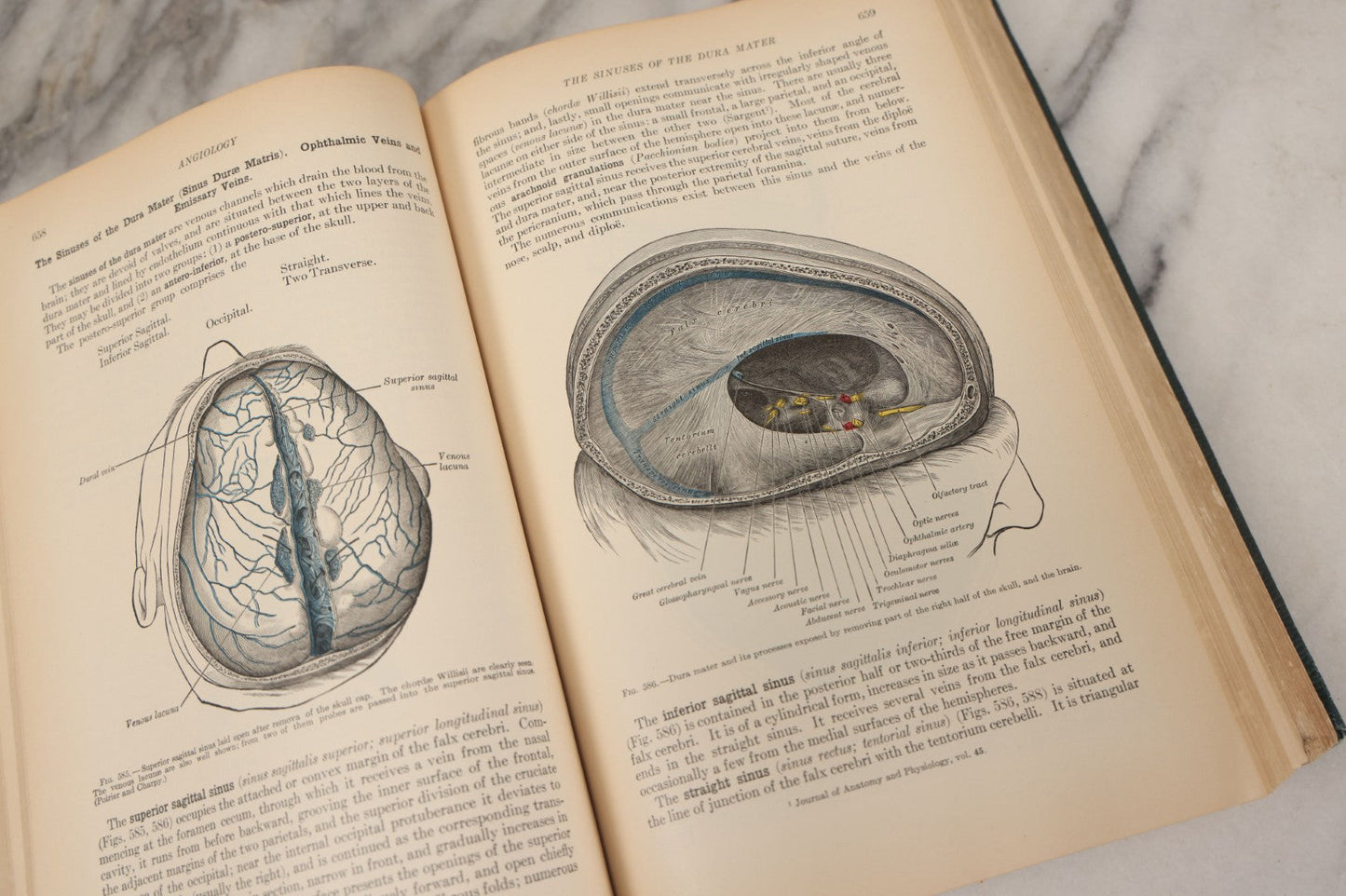 Lot 010 - "Anatomy Of The Human Body" Antique Book By Henry Gray (A.K.A. Gray's Anatomy), Twenty-First Edition, Illustrated With 1283 Engravings, Lea & Febiger Publishers, 1924