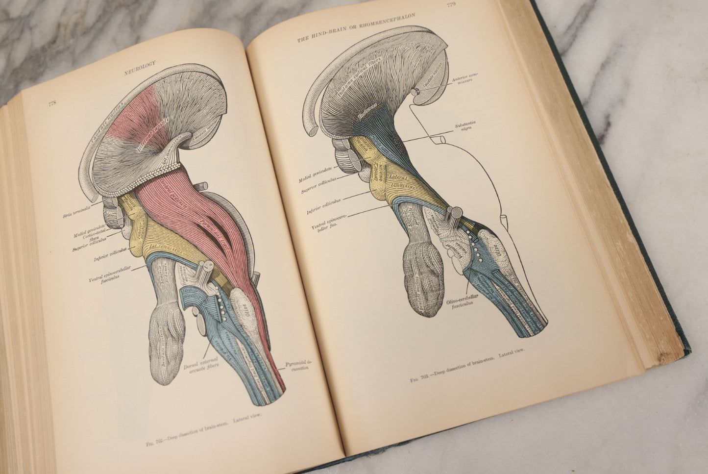 Lot 010 - "Anatomy Of The Human Body" Antique Book By Henry Gray (A.K.A. Gray's Anatomy), Twenty-First Edition, Illustrated With 1283 Engravings, Lea & Febiger Publishers, 1924