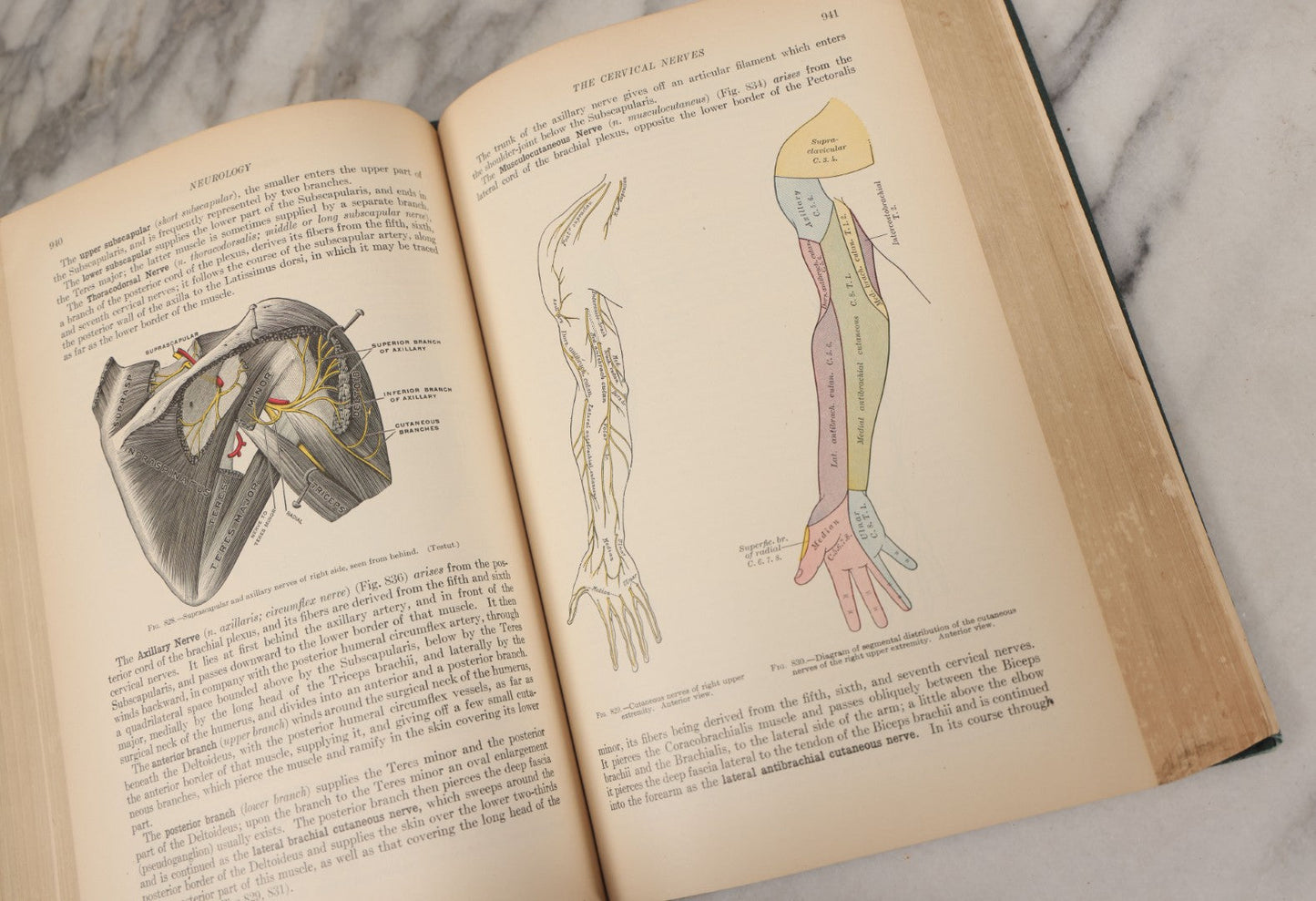 Lot 010 - "Anatomy Of The Human Body" Antique Book By Henry Gray (A.K.A. Gray's Anatomy), Twenty-First Edition, Illustrated With 1283 Engravings, Lea & Febiger Publishers, 1924