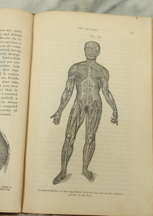 Lot 122 - "The People's Common Sense Medical Adviser In Plain English, Or, Medicine Simplified" Antique Illustrated Medical Book By R.V. Pierce, M.D., Twelfth Revised Edition, Buffalo, New York, 1883