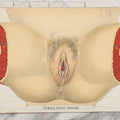 Lot 023 - Antique Medical Anatomy Bookplate Fold Out Diagram Of The Female Pelvic Organs, Folds Out To Show Details Of Anatomy, Mounted To Board, 14-1/2" x 10-1/2"