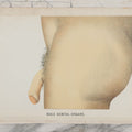 Lot 024 - Antique Medical Anatomy Bookplate Fold Out Double Sided Diagrams Of The Male Genital Organs And Upper And Lower Extremities (Arms And Legs), Folds Out To Show Details Of Anatomy, 14-1/2" x 10-1/2"