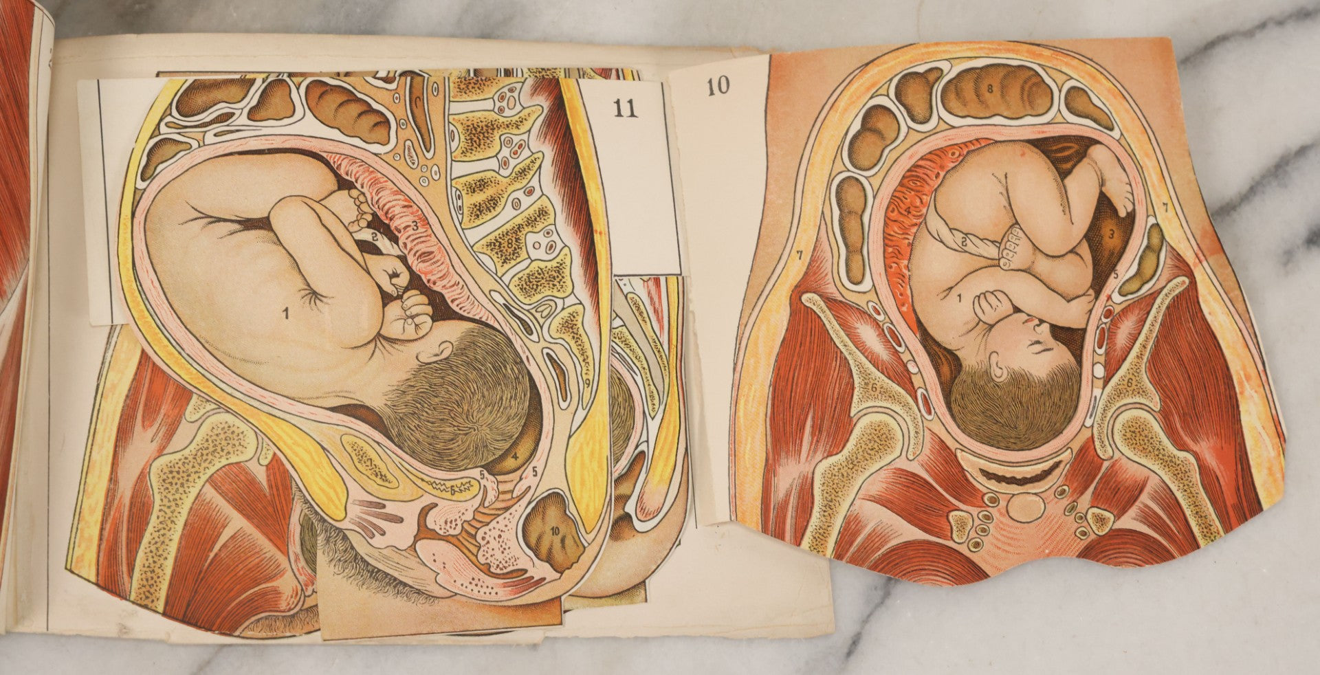 Lot 095 - Antique Paper Fold Out Medical Bookplate Of The Female Reproductive System Womb, Fetus, Etc., Copyright A.A. Marshall, 1919 