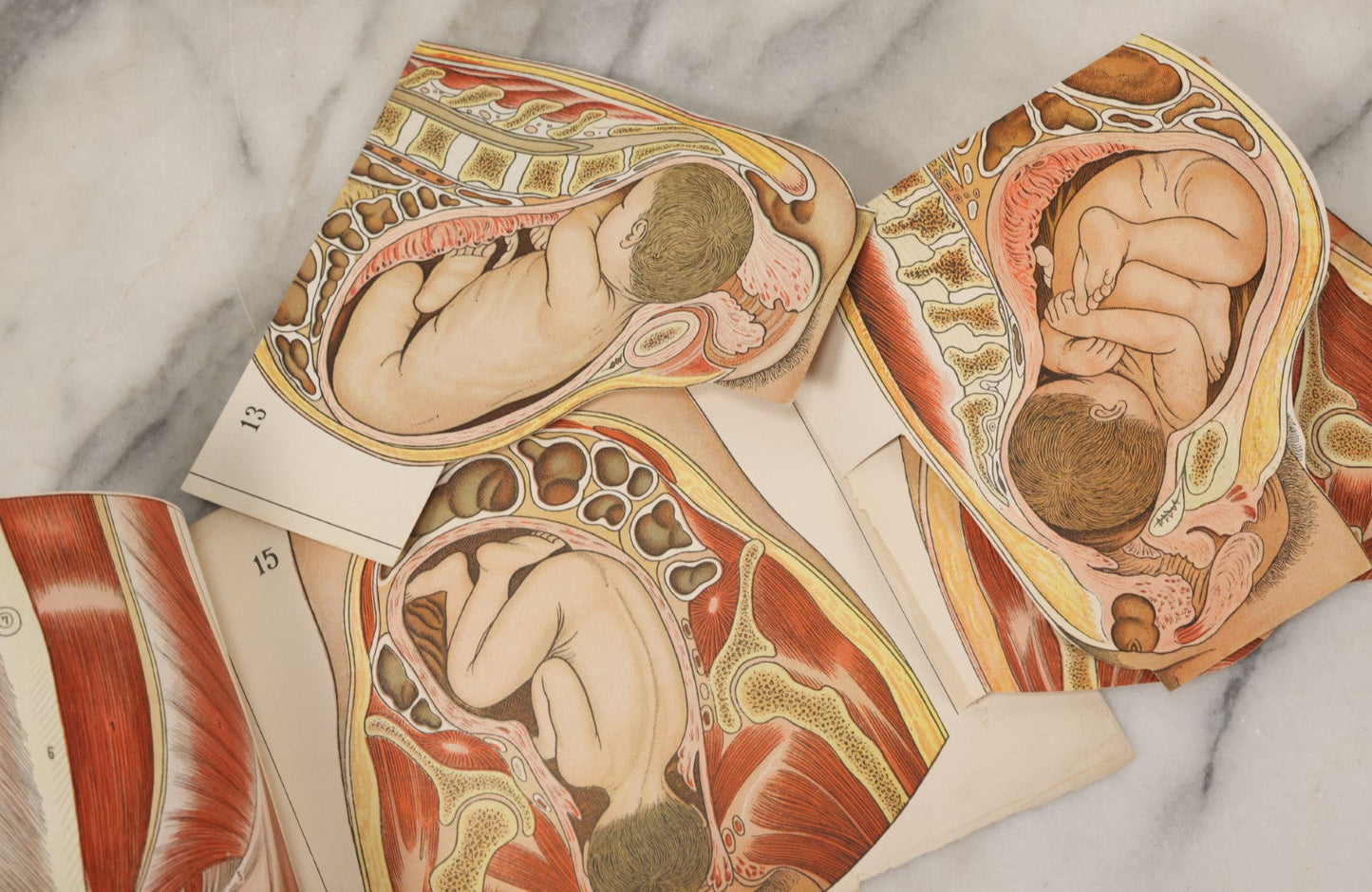 Lot 095 - Antique Paper Fold Out Medical Bookplate Of The Female Reproductive System Womb, Fetus, Etc., Copyright A.A. Marshall, 1919 