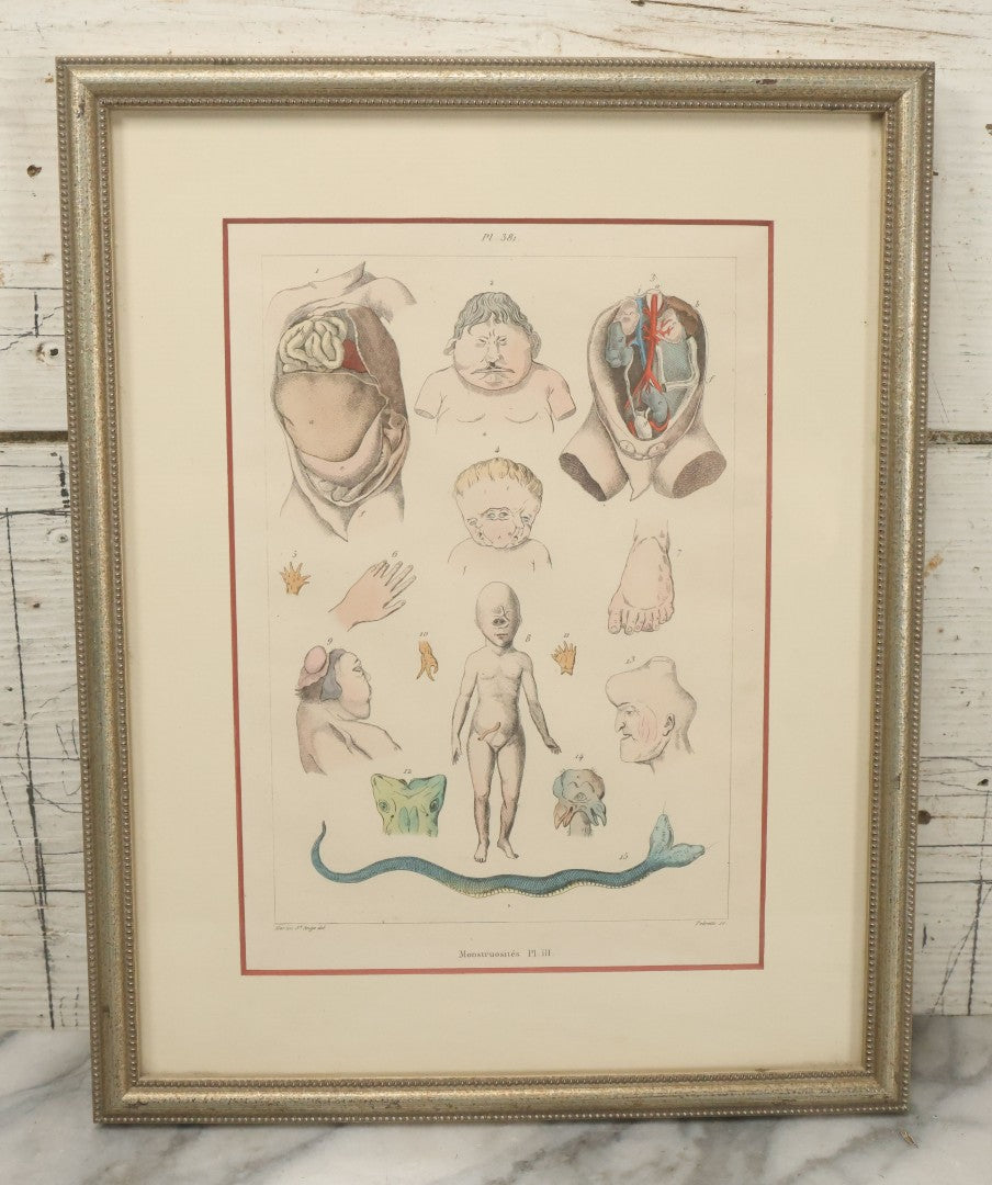 Lot 054 - Antique French Medical Engraving Plate Print, "Monstruosités" (Monstrosities), Featuring Many Medical Oddities, Engraved By Pedretti After Martin St. Ange, In Modern Frame, 10-1/2" x 13-3/8"