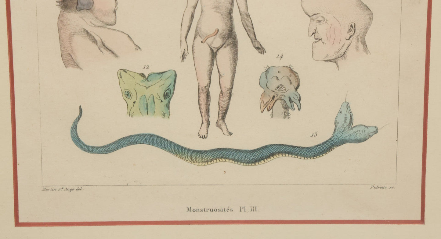 Lot 054 - Antique French Medical Engraving Plate Print, "Monstruosités" (Monstrosities), Featuring Many Medical Oddities, Engraved By Pedretti After Martin St. Ange, In Modern Frame, 10-1/2" x 13-3/8"