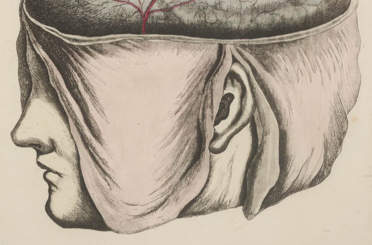 Lot 057 - Antique Late 18th Century Aquatint Anatomical Print, Plate 58, Dissected Head, By A. Fyfe, In Modern Frame, 14-1/4" x 15-1/4"