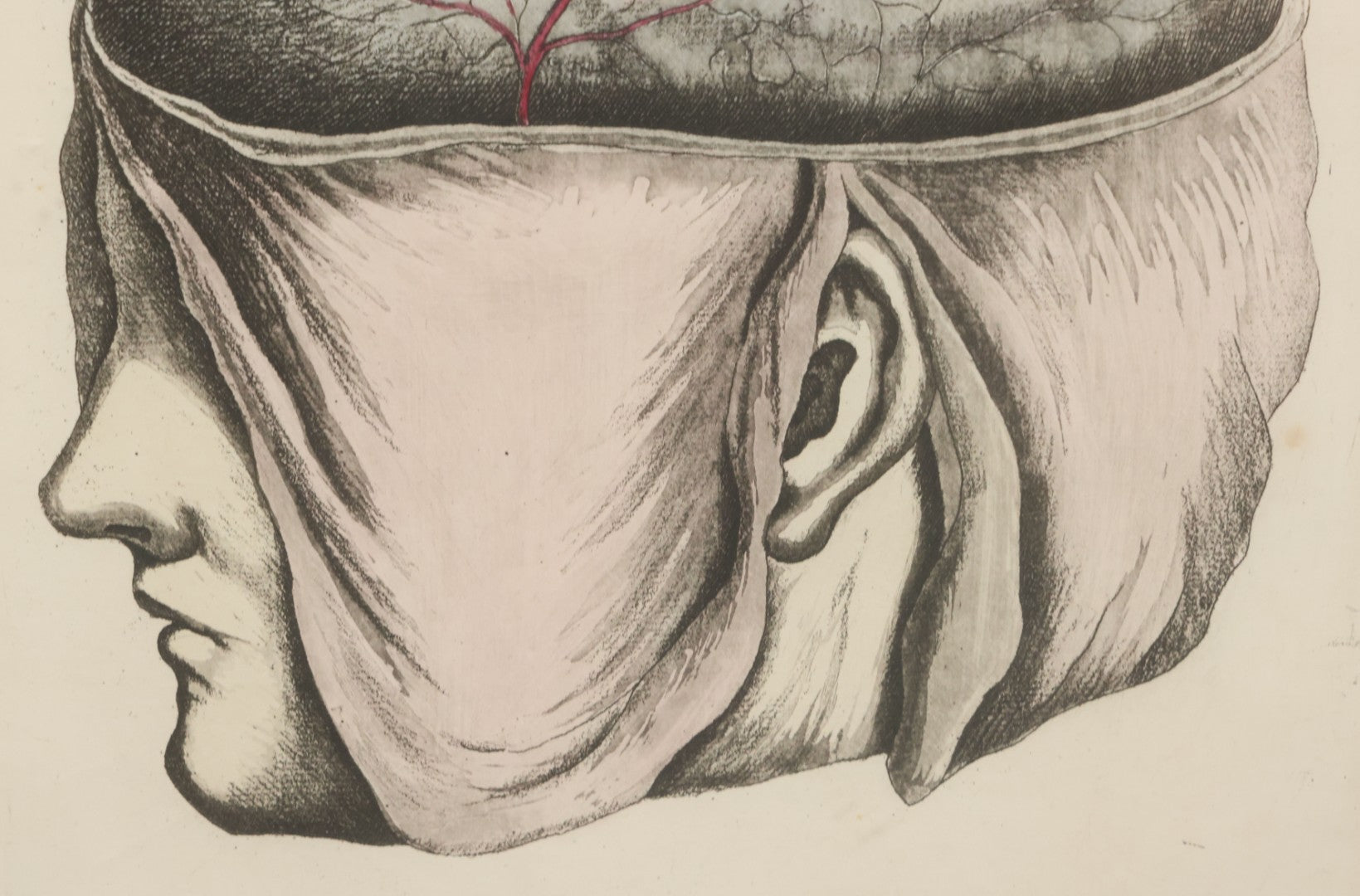 Lot 057 - Antique Late 18th Century Aquatint Anatomical Print, Plate 58, Dissected Head, By A. Fyfe, In Modern Frame, 14-1/4" x 15-1/4"