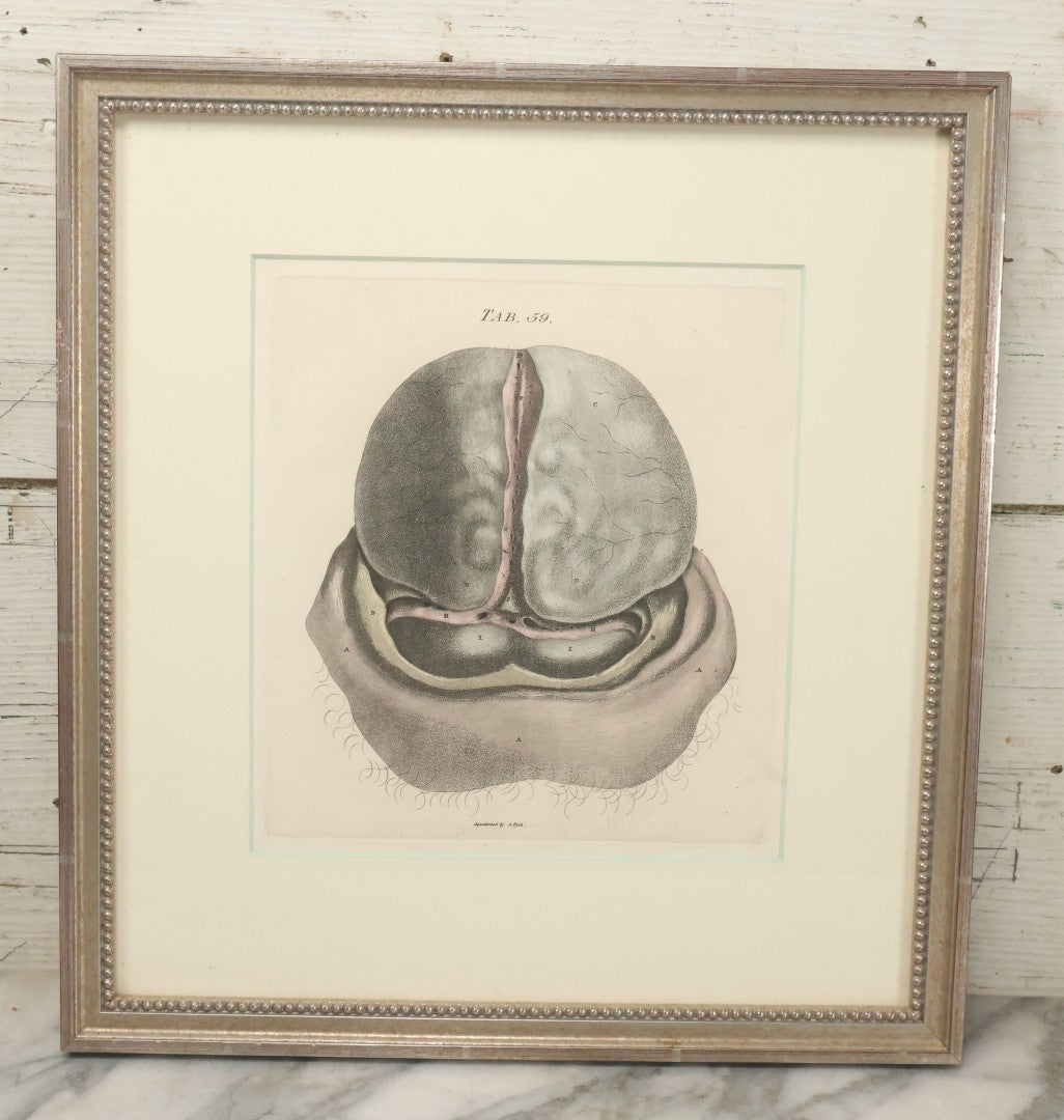 Lot 058 - Antique Late 18th Century Aquatint Anatomical Print, Plate 59, Dissected Head, By A. Fyfe, In Modern Frame, 14-1/4" x 15-1/4"