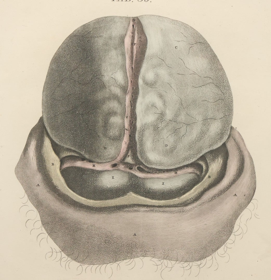Lot 058 - Antique Late 18th Century Aquatint Anatomical Print, Plate 59, Dissected Head, By A. Fyfe, In Modern Frame, 14-1/4" x 15-1/4"