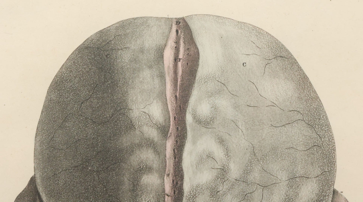 Lot 058 - Antique Late 18th Century Aquatint Anatomical Print, Plate 59, Dissected Head, By A. Fyfe, In Modern Frame, 14-1/4" x 15-1/4"