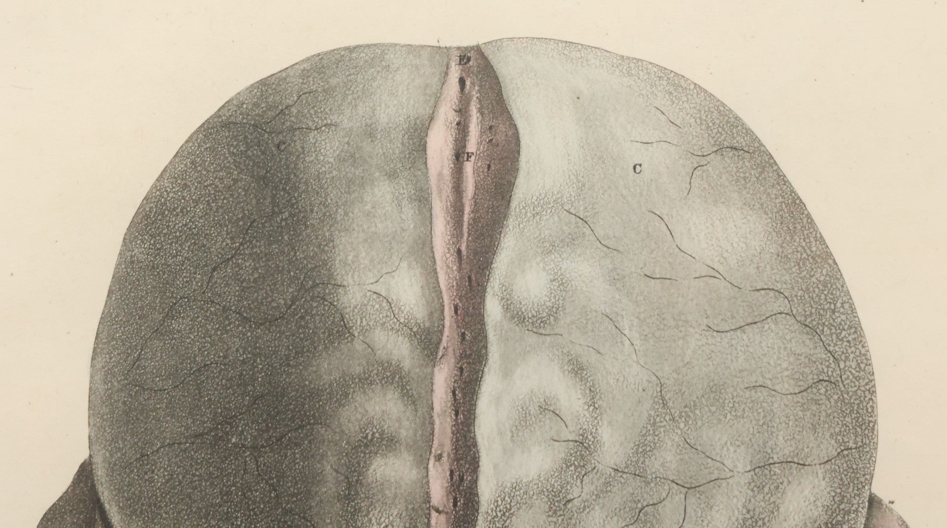 Lot 058 - Antique Late 18th Century Aquatint Anatomical Print, Plate 59, Dissected Head, By A. Fyfe, In Modern Frame, 14-1/4" x 15-1/4"