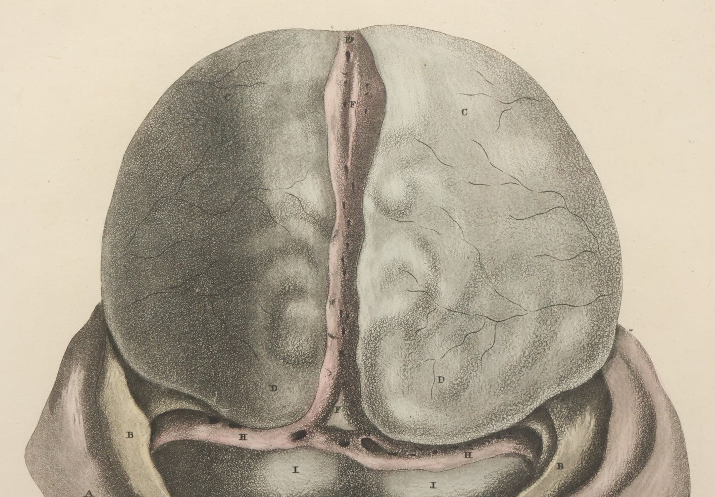 Lot 058 - Antique Late 18th Century Aquatint Anatomical Print, Plate 59, Dissected Head, By A. Fyfe, In Modern Frame, 14-1/4" x 15-1/4"