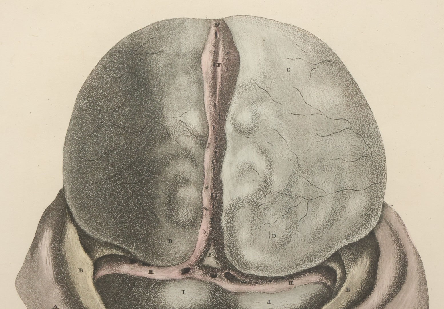 Lot 058 - Antique Late 18th Century Aquatint Anatomical Print, Plate 59, Dissected Head, By A. Fyfe, In Modern Frame, 14-1/4" x 15-1/4"