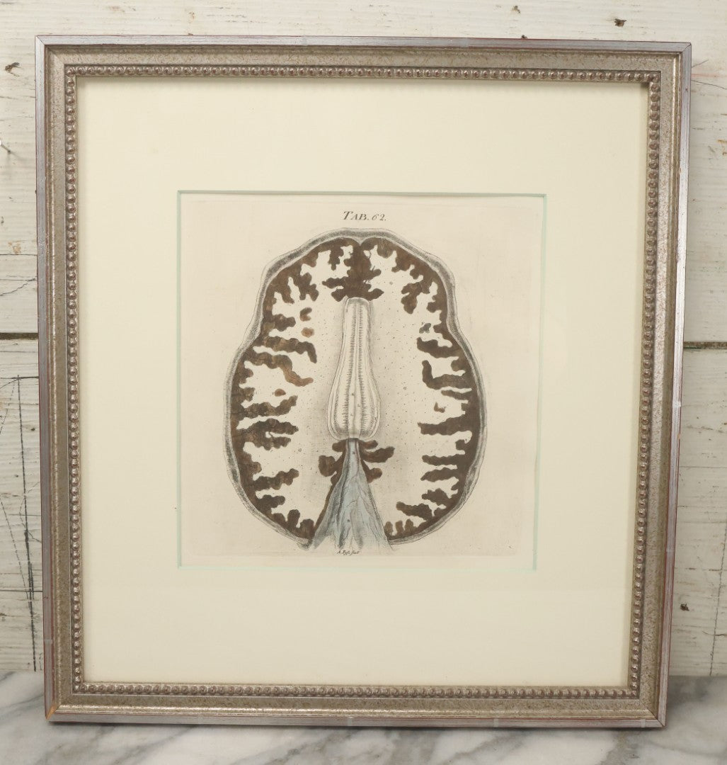 Lot 059 - Antique Late 18th Century Aquatint Anatomical Print, Plate 62, View Of The Brain, By A. Fyfe, In Modern Frame, 14-1/4" x 15-1/4"