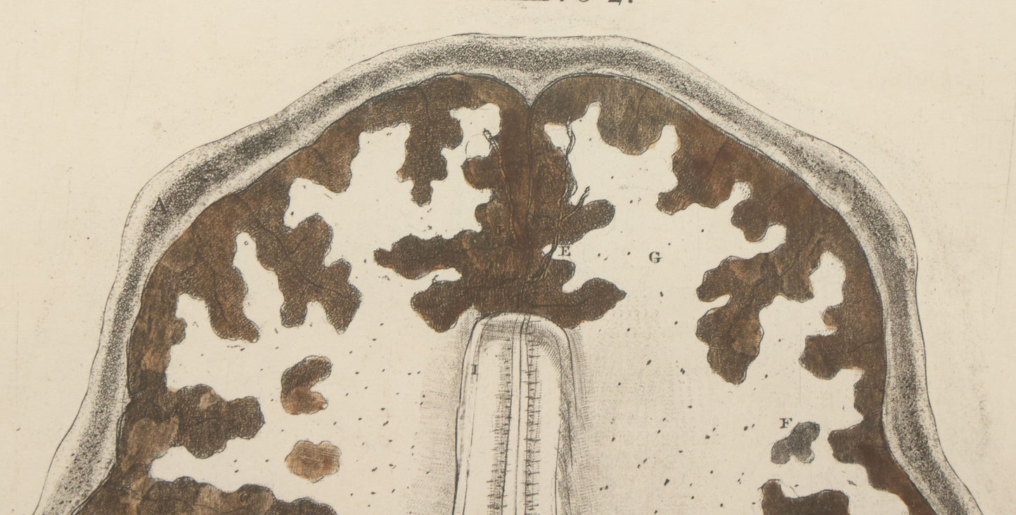 Lot 059 - Antique Late 18th Century Aquatint Anatomical Print, Plate 62, View Of The Brain, By A. Fyfe, In Modern Frame, 14-1/4" x 15-1/4"