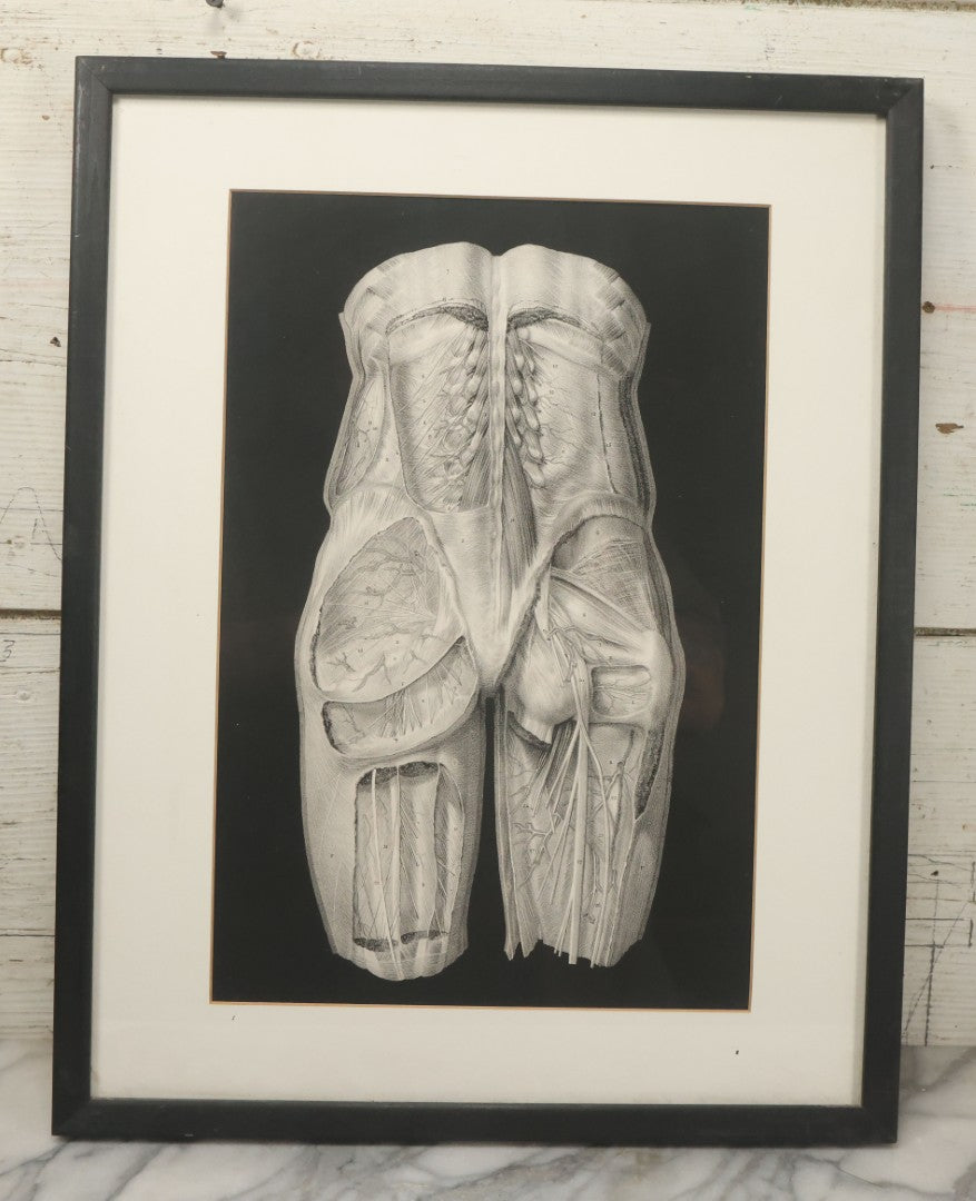 Lot 060 - Antique Black And White Anatomical Print After N. H. Jacob Showing A Dissection Of The Human Back Side, In Modern Frame, 14-7/8" x 19"