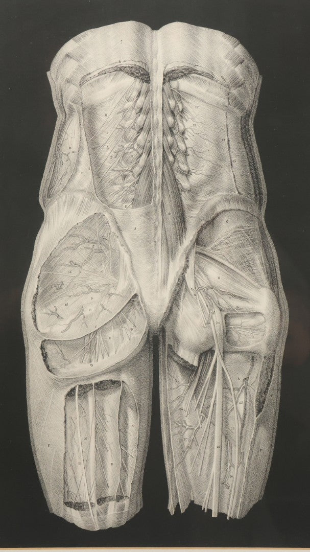 Lot 060 - Antique Black And White Anatomical Print After N. H. Jacob Showing A Dissection Of The Human Back Side, In Modern Frame, 14-7/8" x 19"