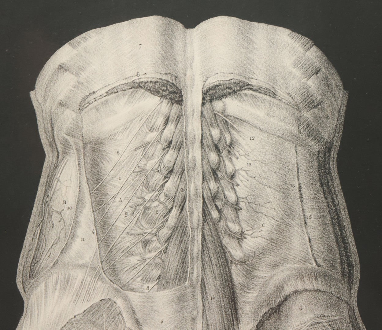 Lot 060 - Antique Black And White Anatomical Print After N. H. Jacob Showing A Dissection Of The Human Back Side, In Modern Frame, 14-7/8" x 19"